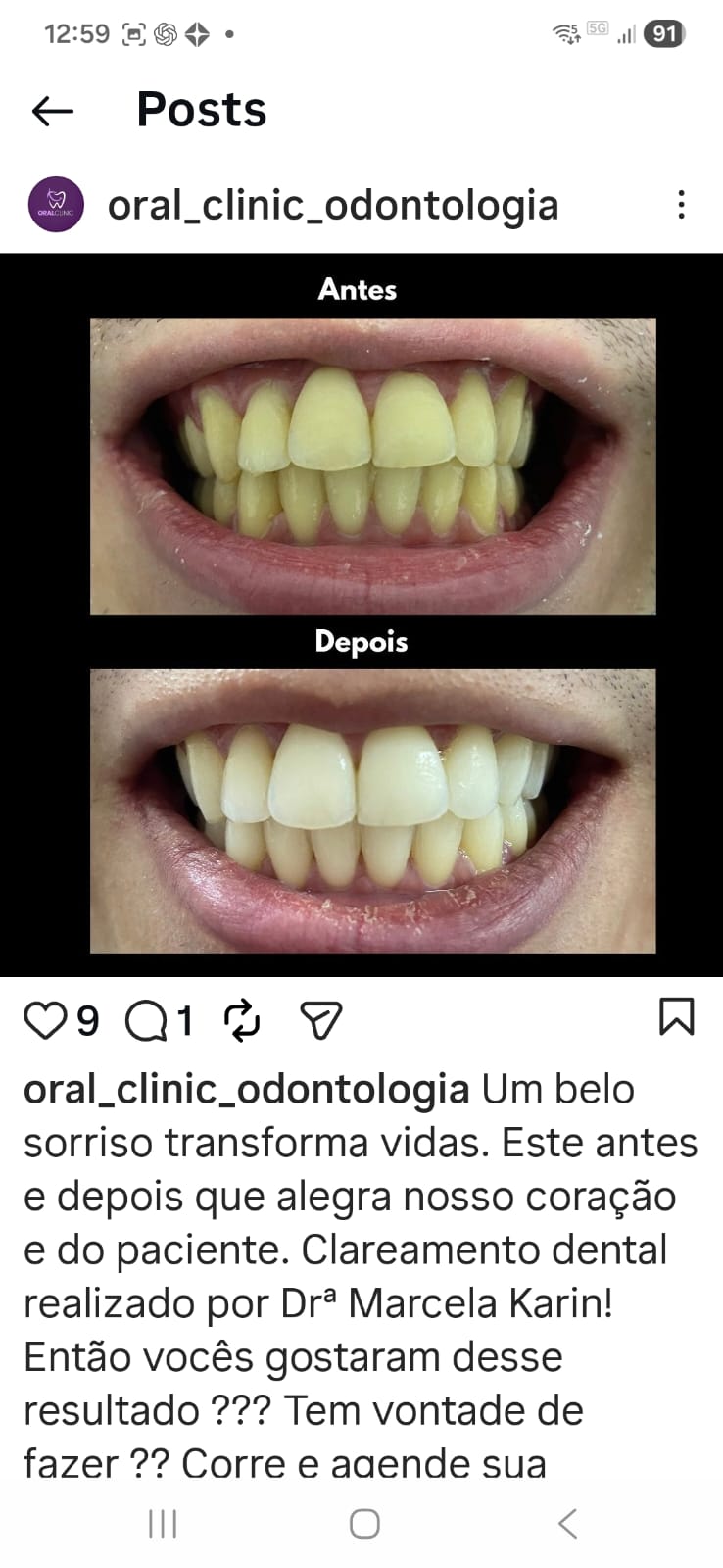 Caso Clínico 1